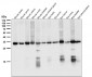Anti-NGFR/P75 Rabbit Monoclonal Antibody
